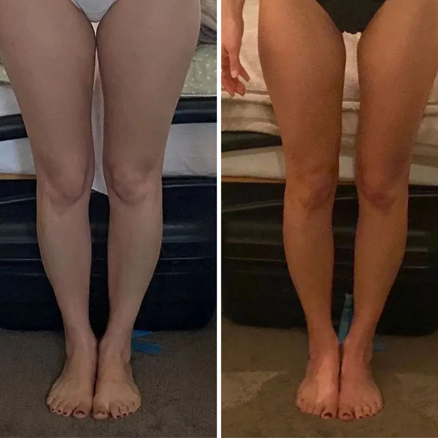 Compression LympaWave™ Leggings