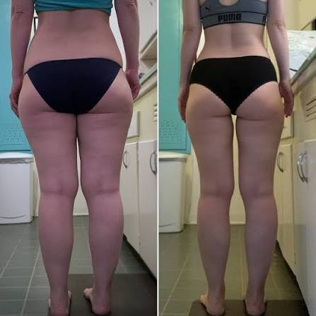 Compression LympaWave™ Leggings