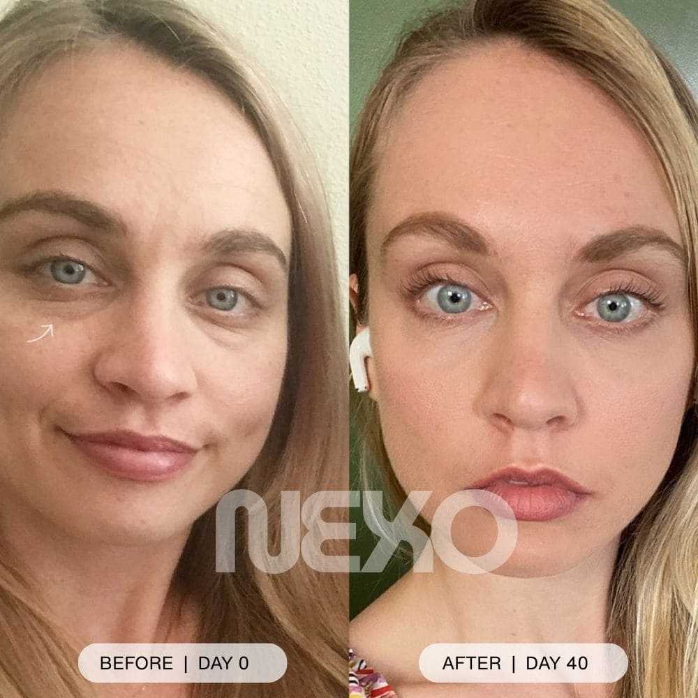DermaLume™ – Advanced 2 in 1 Under - Eye Rejuvenation Technology - Nexo™