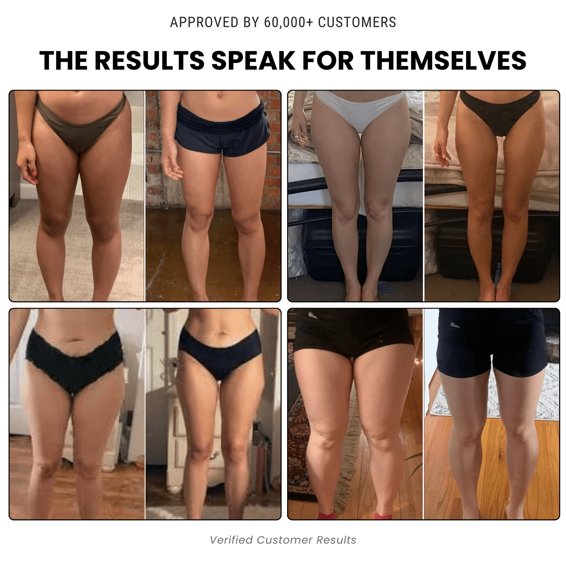 Lymphawave™ - Compression Lymphatic Drainage Leggings - Nexo™