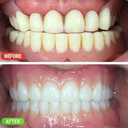 NexoPod™ - Dental Grade Deep Cleaning for Dentures