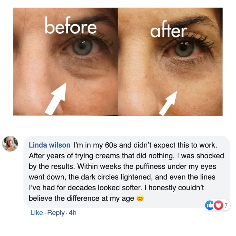 DermaLume™ – Advanced 2 in 1 Under - Eye Rejuvenation Technology - Nexo™