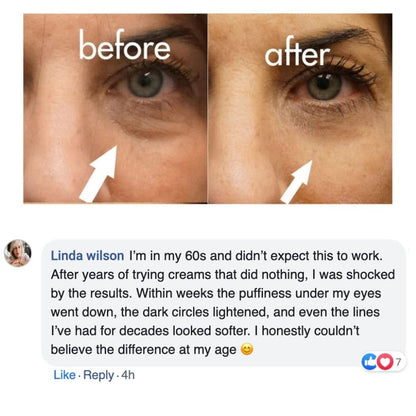 DermaLume™ – Advanced 2 in 1 Under - Eye Rejuvenation Technology - Nexo™