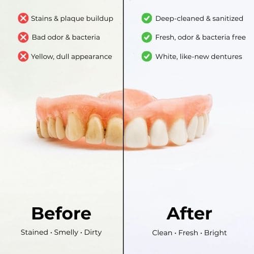 NexoPod™ - Dental Grade Deep Cleaning for Dentures