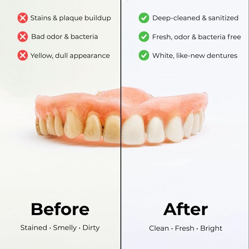 NexoPod™ - Dental Grade Deep Cleaning for Dentures - Nexo™