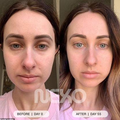 DermaLume™ – Advanced 2 in 1 Under - Eye Rejuvenation Technology - Nexo™